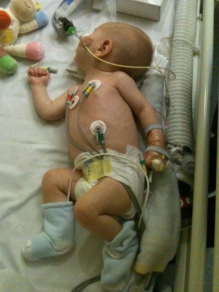 A small baby in a hospital cot with a feeing tube in their nose, connected to wires monitoring them