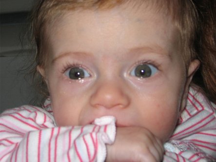 Watery eyed baby Lily wearing a pink and white babygro