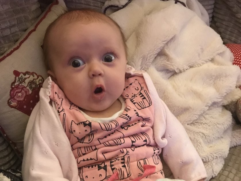 A baby with mitochondrial disease lying on blankets staring at the camera
