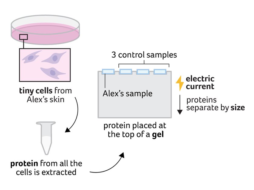 Illustration of how a skin biopsy works