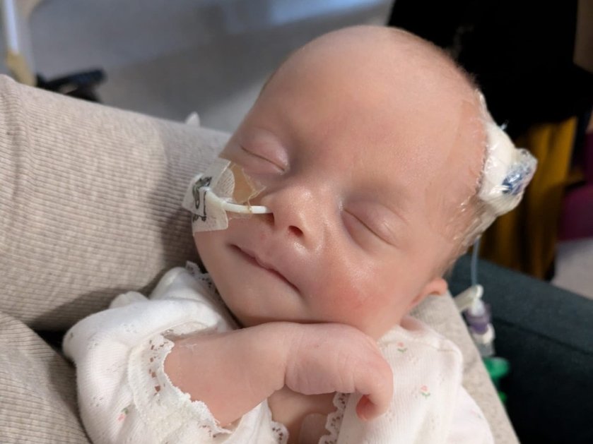 Close-up of a tiny newborn baby sleeping, with a feeding tube in her nose