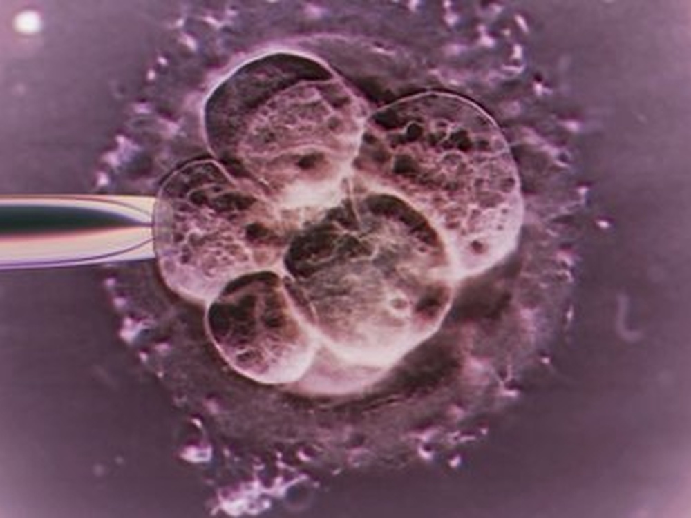 embryo in the early stages of cell multiplication