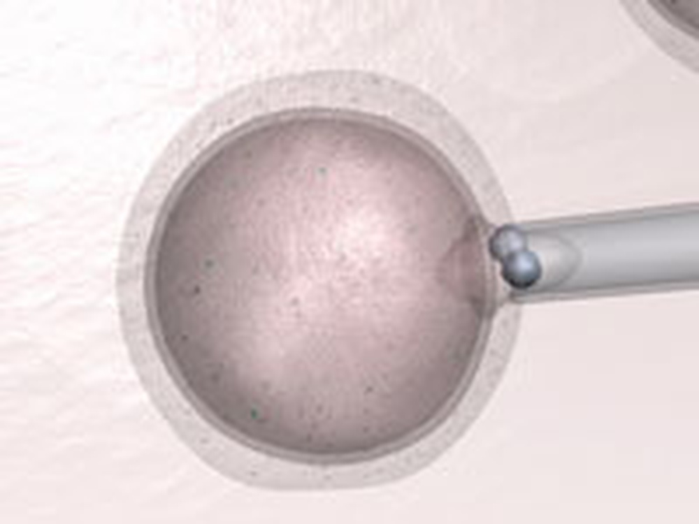 A picture of a human egg with a needle being inserted into it