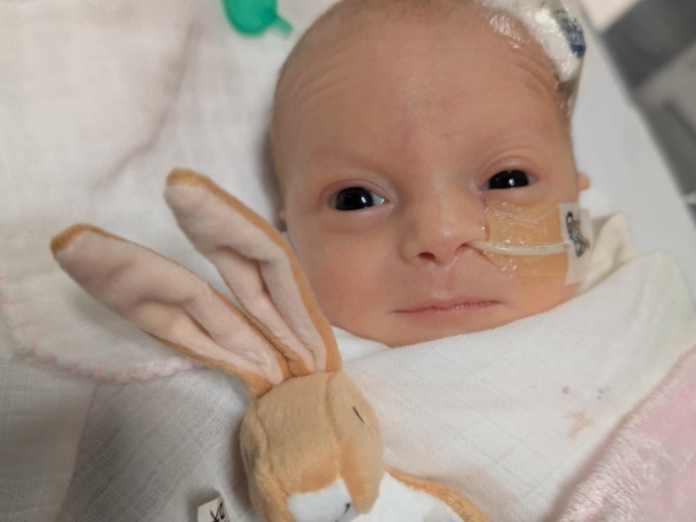 A tiny baby lying in a hospital bed with a feeding tube in her nose