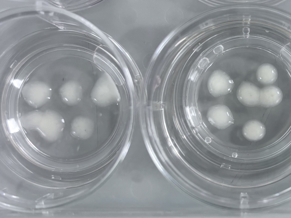 Close-up of 'mini brains', or organoids, on a petri dish in a science lab